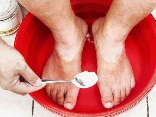 Sodabäder gegen Pilze