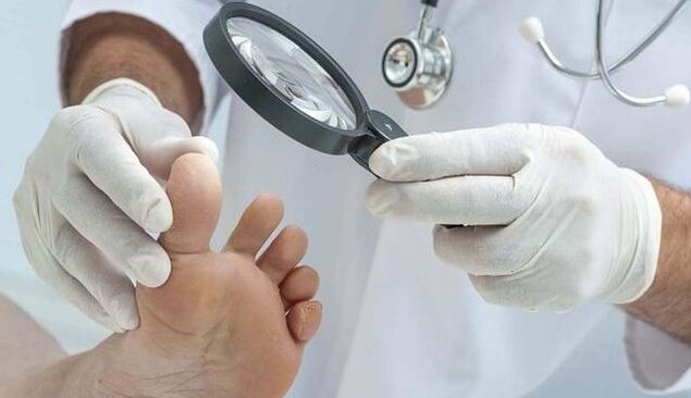 Diagnose von Pilzen
